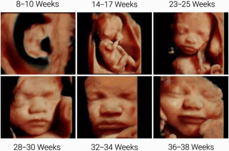 3d ultrasound how much